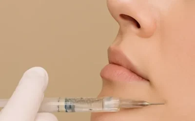 Carboxiterapia facial en Málaga: Rejuvenecimiento y bienestar para tu piel