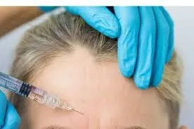 ✨ El Arte de Detener el Tiempo: Neuromoduladores y la Belleza de una Piel Serena